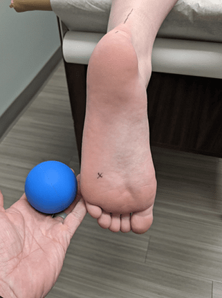 Lateral foot mob ball placement Proper lacrosse ball placement for lateral plantar fascia release is in between and just behind the 4th and 5th metatarsal heads.