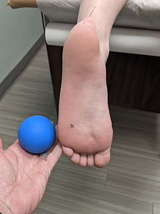 Lateral foot mob ball placement Proper lacrosse ball placement for lateral plantar fascia release is in between and just behind the 4th and 5th metatarsal heads.